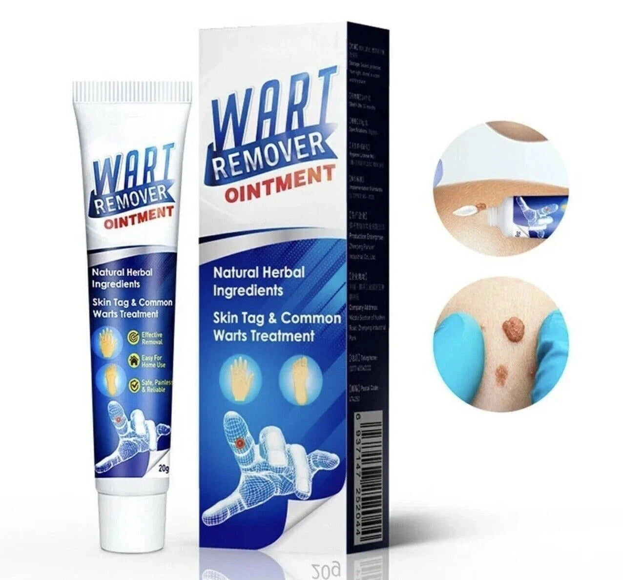 Warts Remover Cream