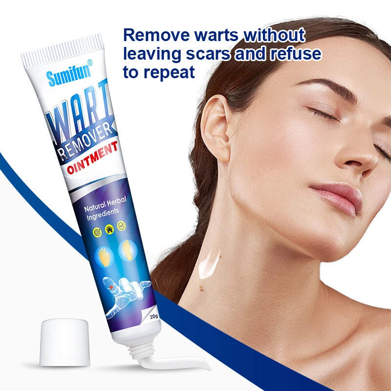 Warts Remover Cream