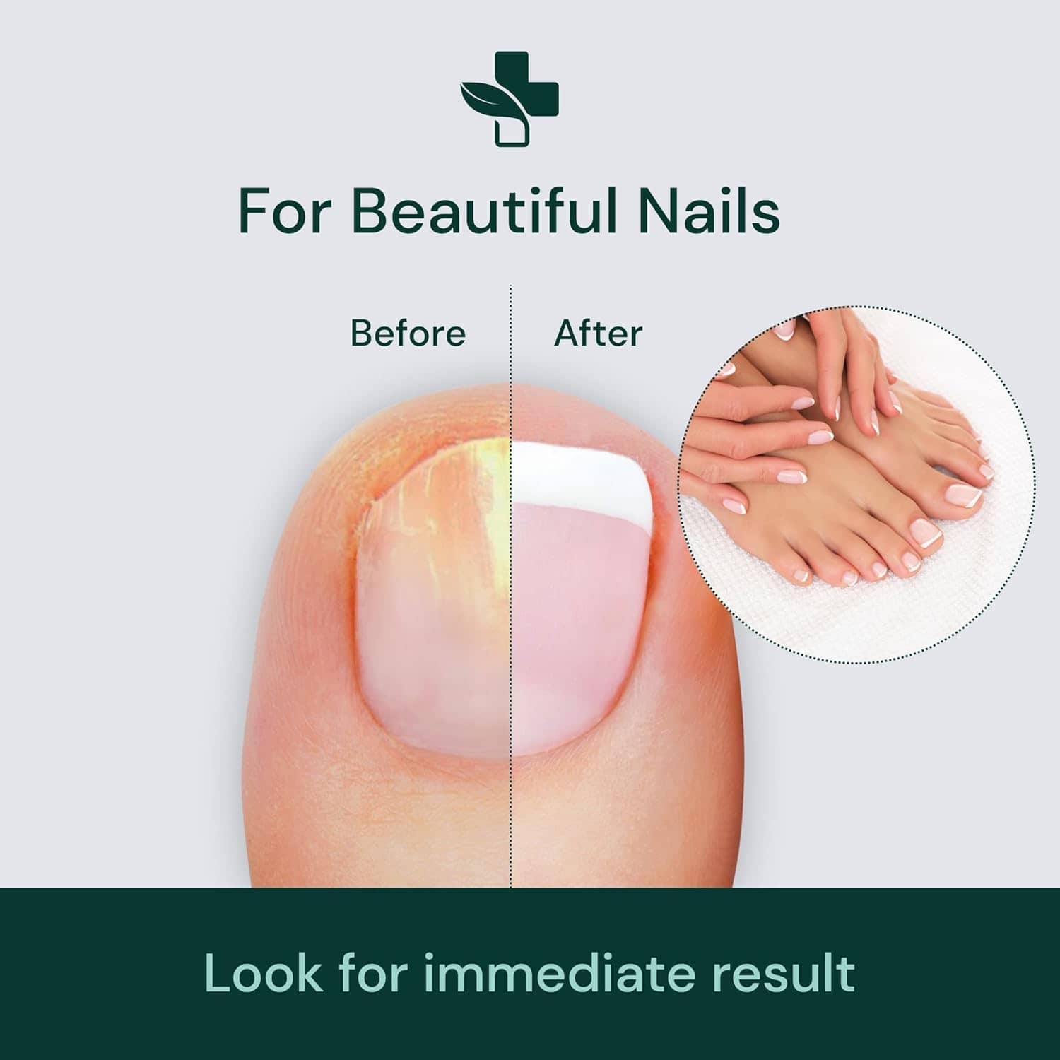 NailCure